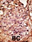 Chemokine Receptor D6 (CCBP2) Antibody (N-term)